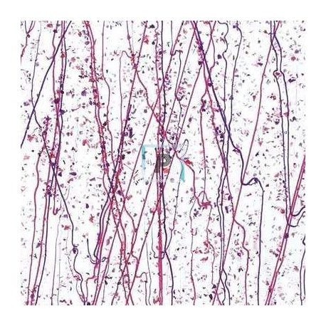 Mardi Gras Arandano y Purpura 4234 89x51cm